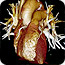 Heart on Osirix