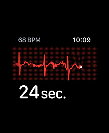 ECG app, beats per minute in top left corner, rhythm line, timer