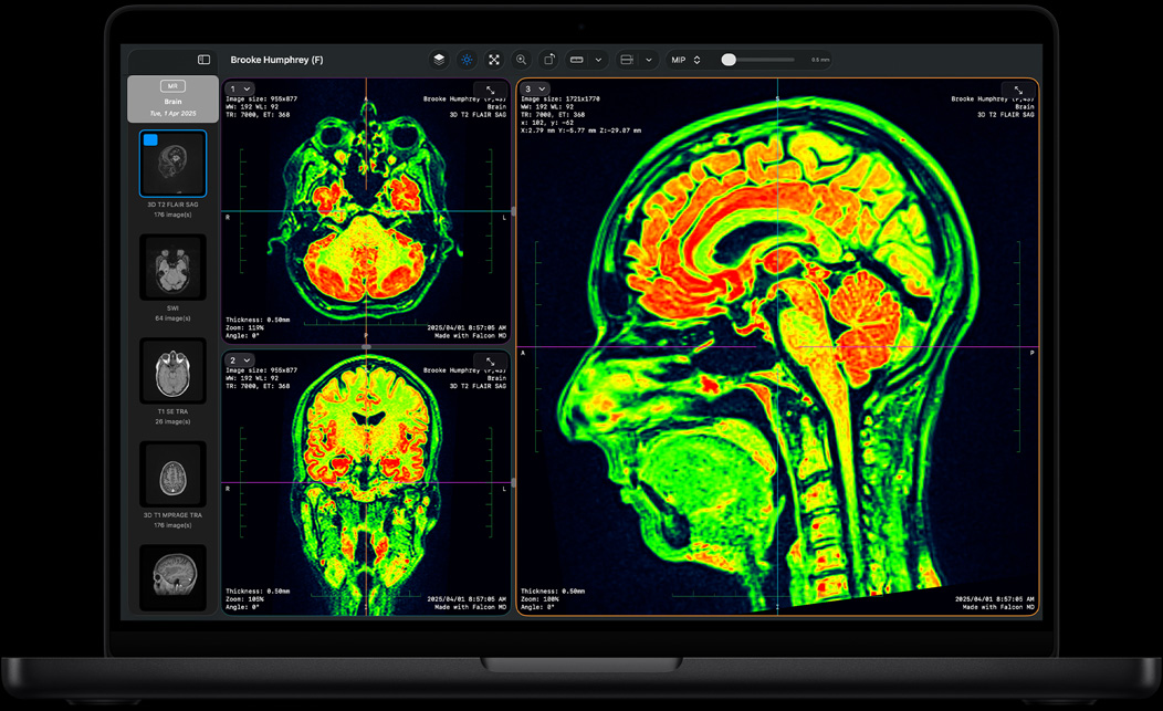 Ecranul MacBook Pro afișează aplicația Falcon MD