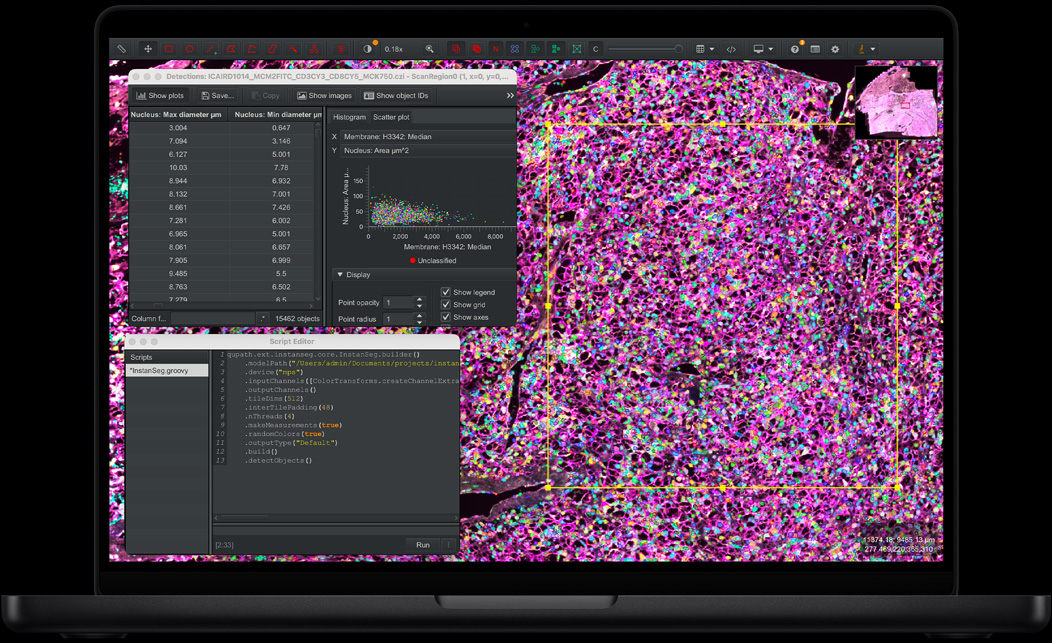 MacBook Pro, QuPath, amostra de tecido manchado com fluorescente em rosa, roxo e verde, painel do Editor de Scripts com código, tabela de detecção mostrando as medidas do diâmetro do núcleo, gráfico de dispersão